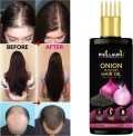 Phillauri Onion Hair Oil With Black Seed Oil Extracts – Controls Hair Fall 100Ml Hair Oil(100 Ml)